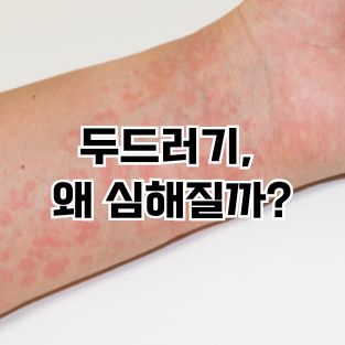 두드러기 왜 심해질까